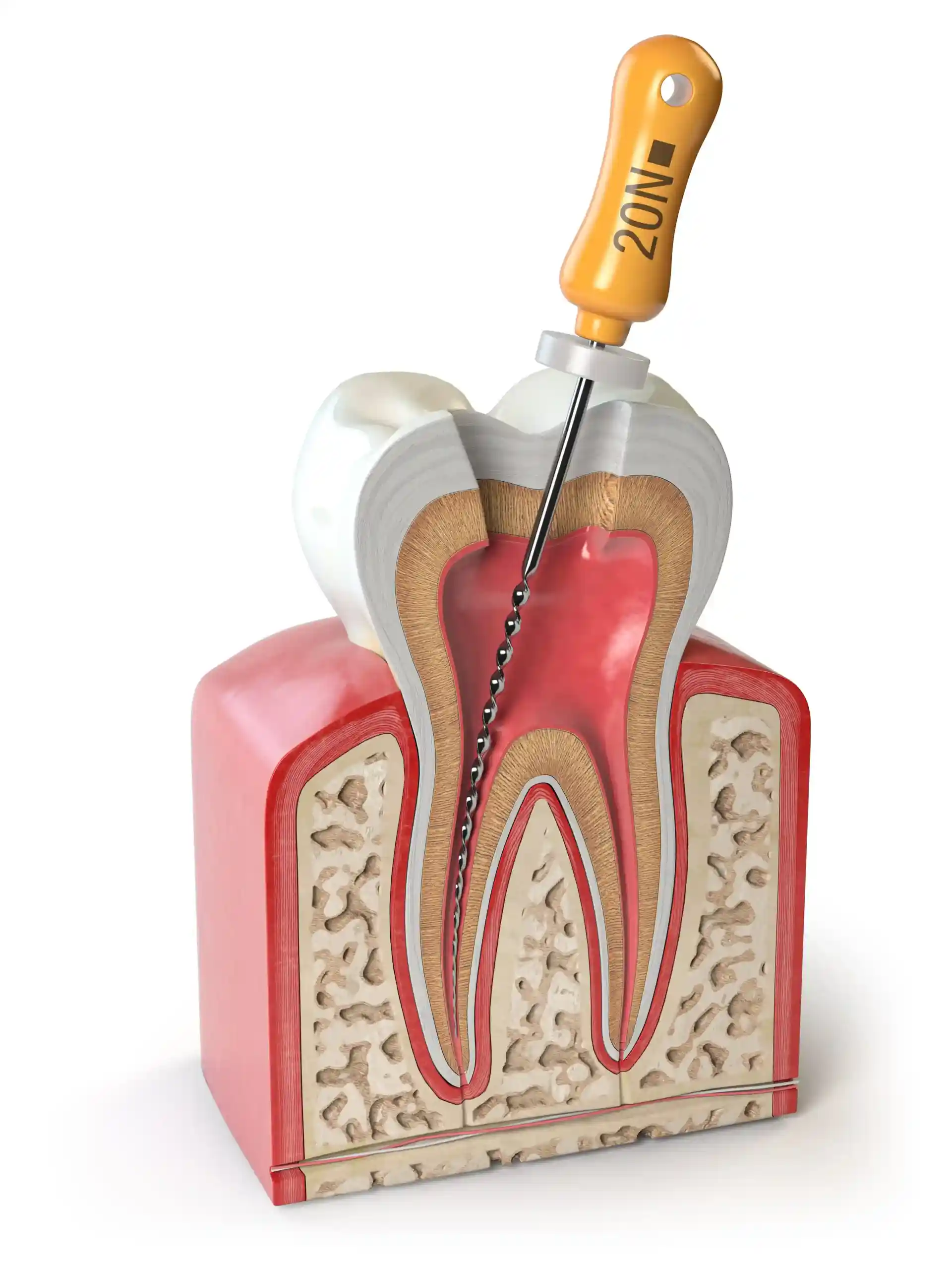 Endodontics diagram